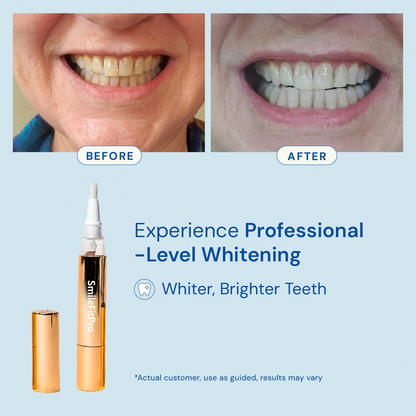Extra-Strength Teeth Whitening Serum Pen