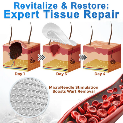 Tissue repair illustration