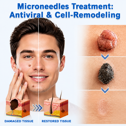 Microneedle treatment illustration