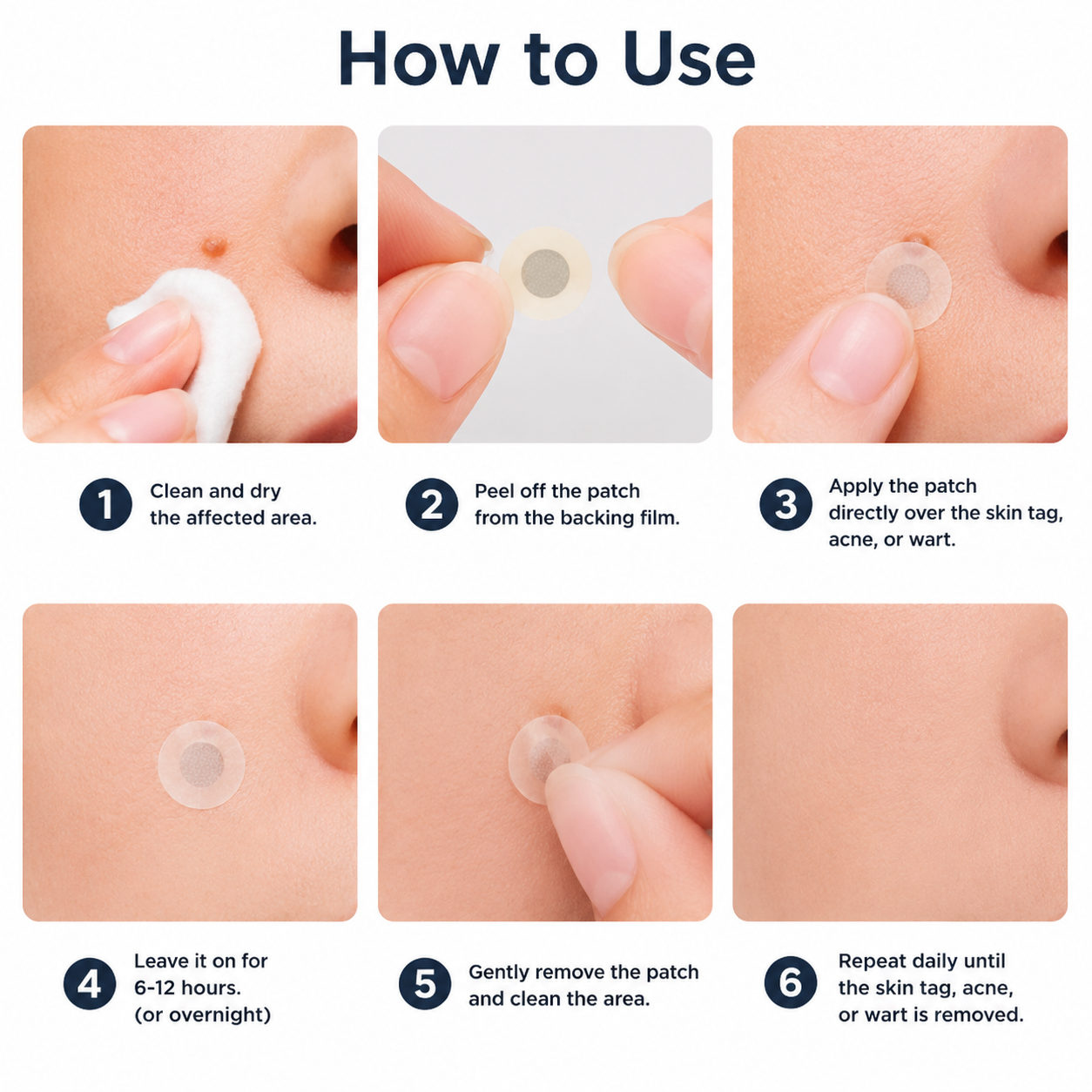 How to use microneedle hydrocolloid patch